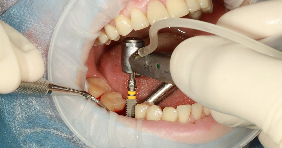 Brewster NY Cosmetic Dentistry