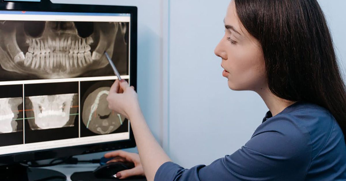 dental x-rays