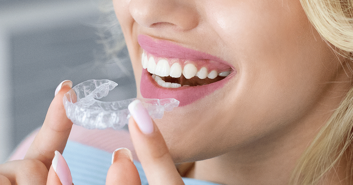 a woman is holding a clear brace in her mouth .
