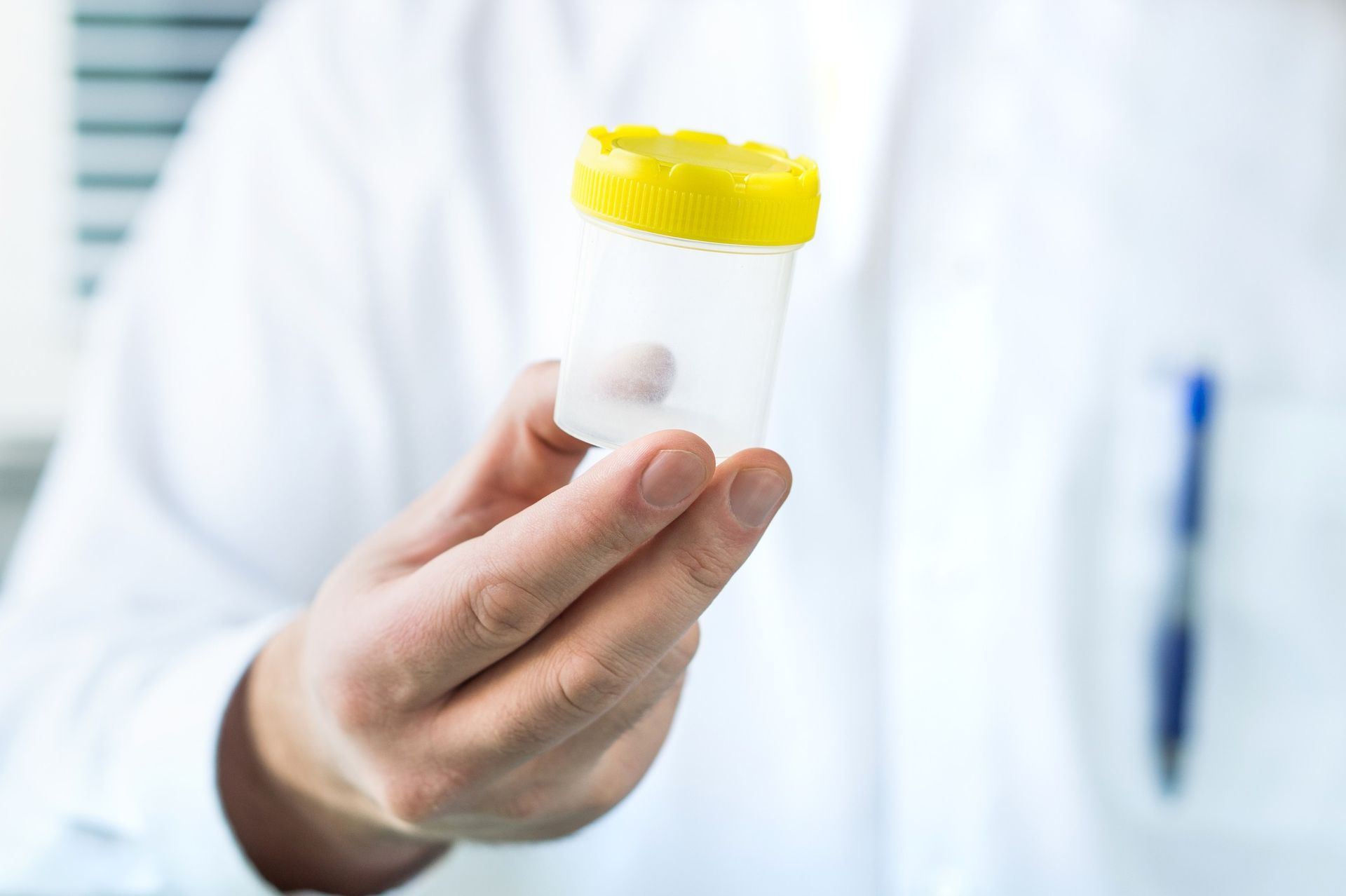 Person in lab coat holds a urine sample container with a yellow lid.