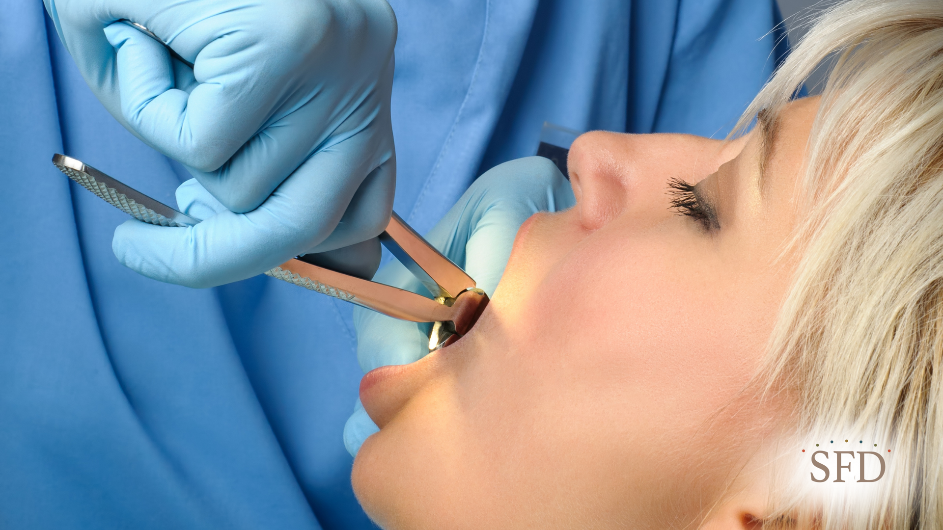 A woman is getting her teeth removed by a dentist.