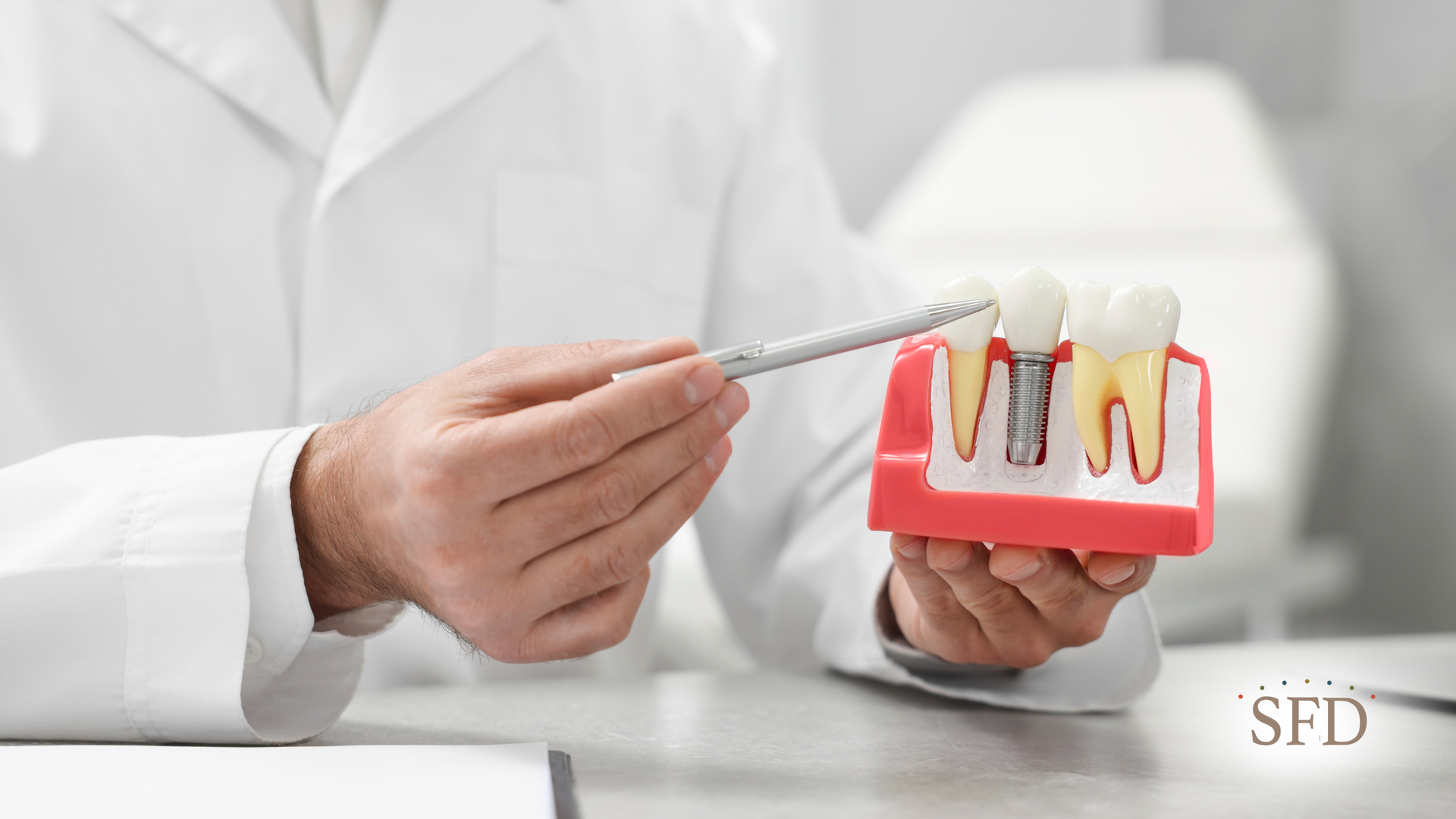 A dentist is holding a model of a dental implant in his hands.