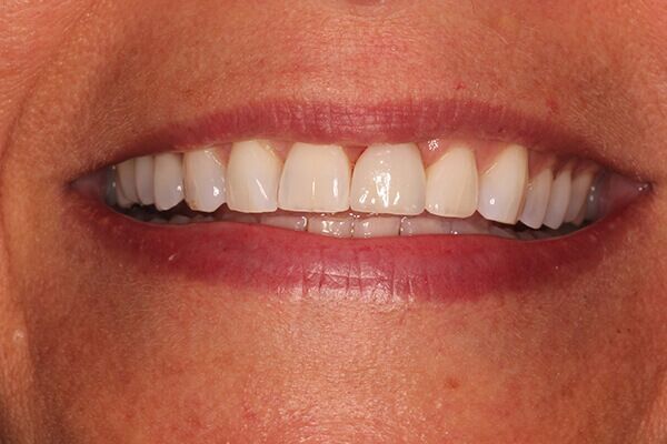 A close up of a woman 's smile with white teeth and red lips.