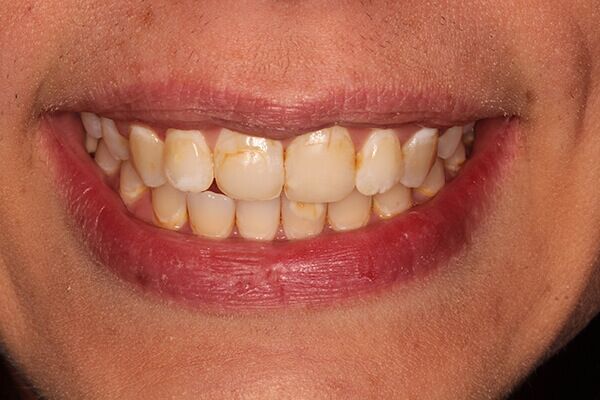 A close up of a woman 's smile with white teeth and red lips.