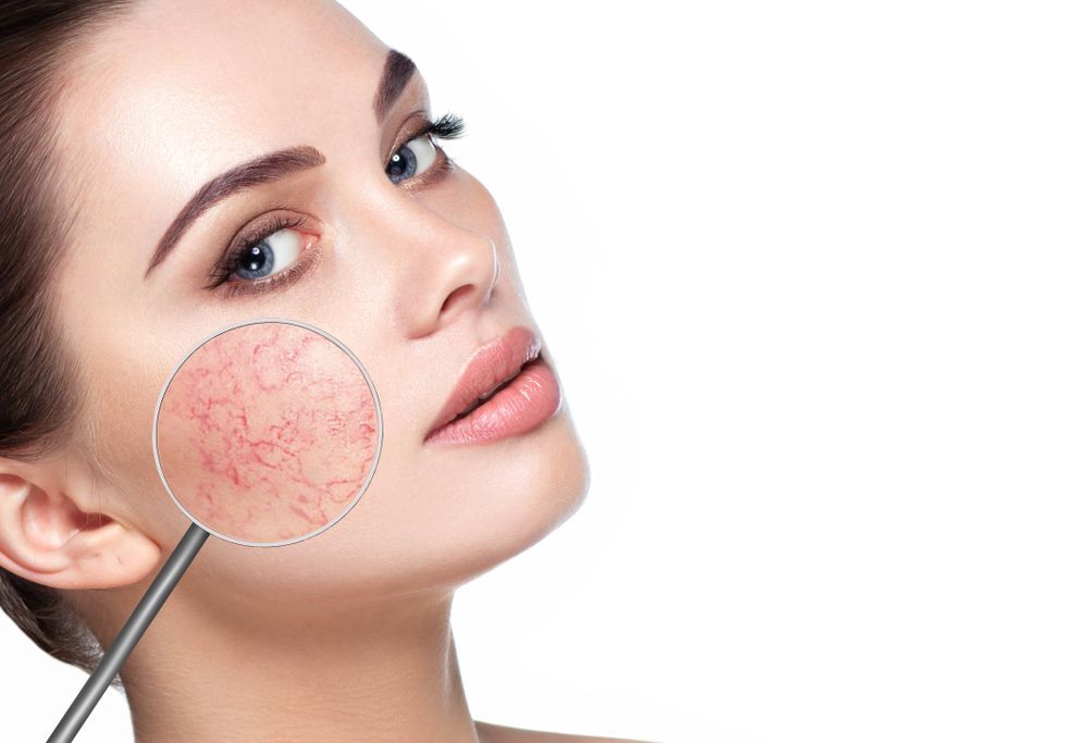 Woman is Getting a Laser Hair Removal Treatment on Her Underarm — Advanced Cosmetic & Beauty Clinic in Bundaberg South, QLD
