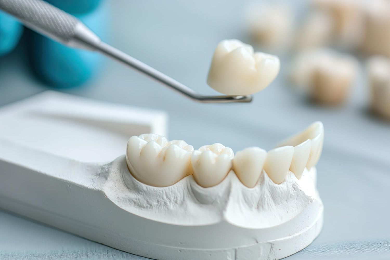 Dentist placing a white dental crown on a model of teeth with tweezers