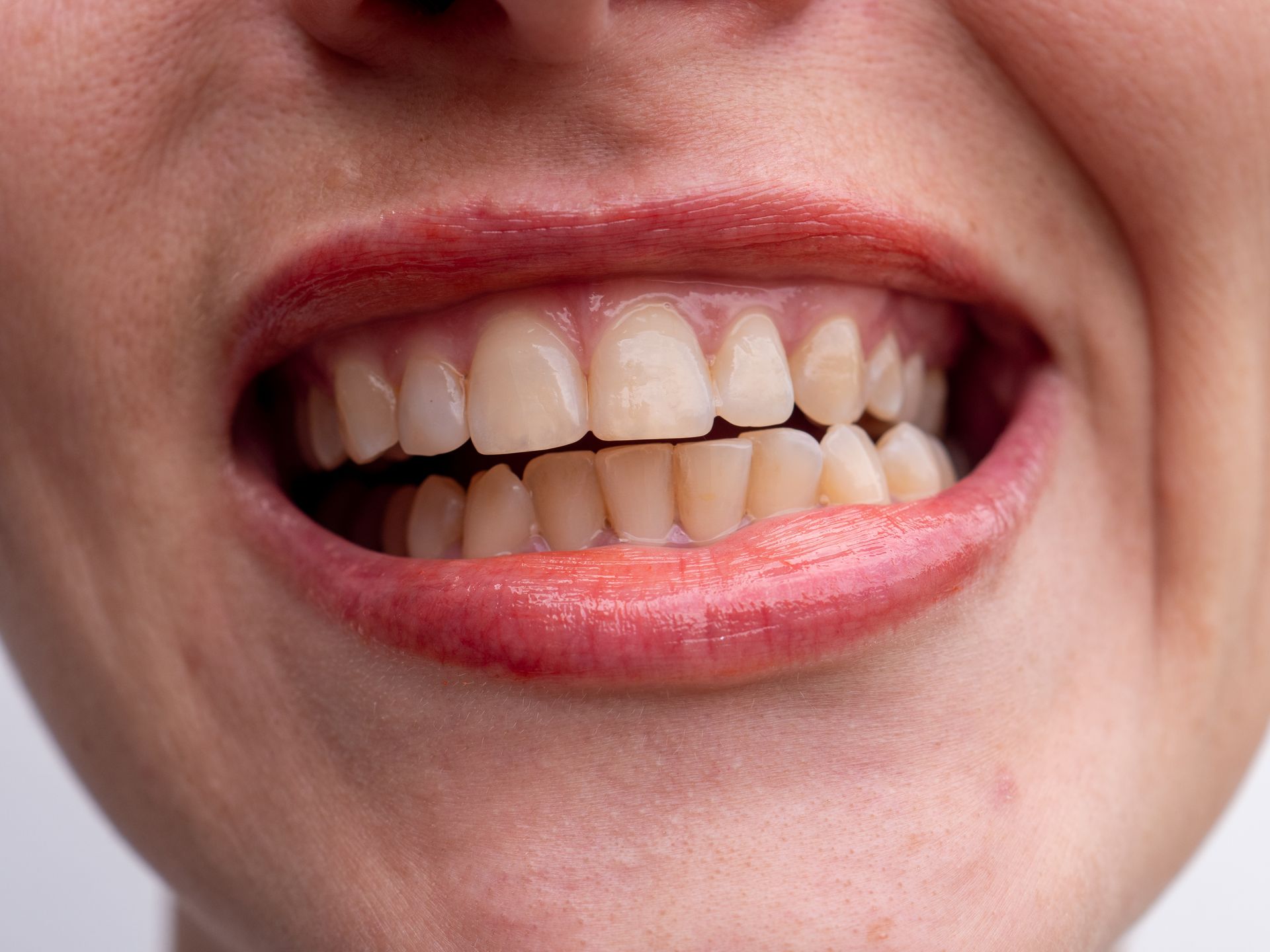 Close-up of a smiling mouth showing teeth and pink lips