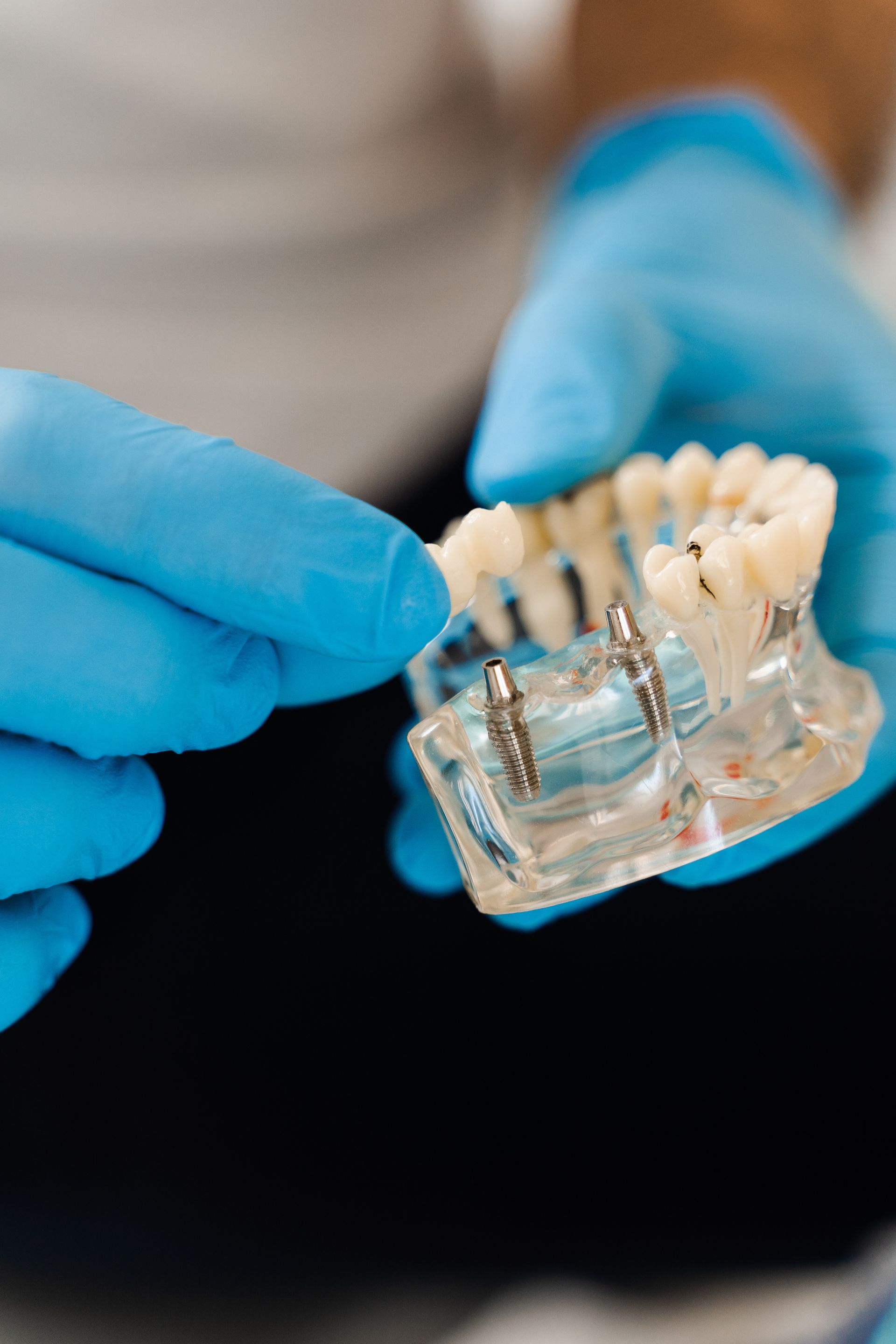 Blue-gloved hands holding a clear dental aligner with teeth molds