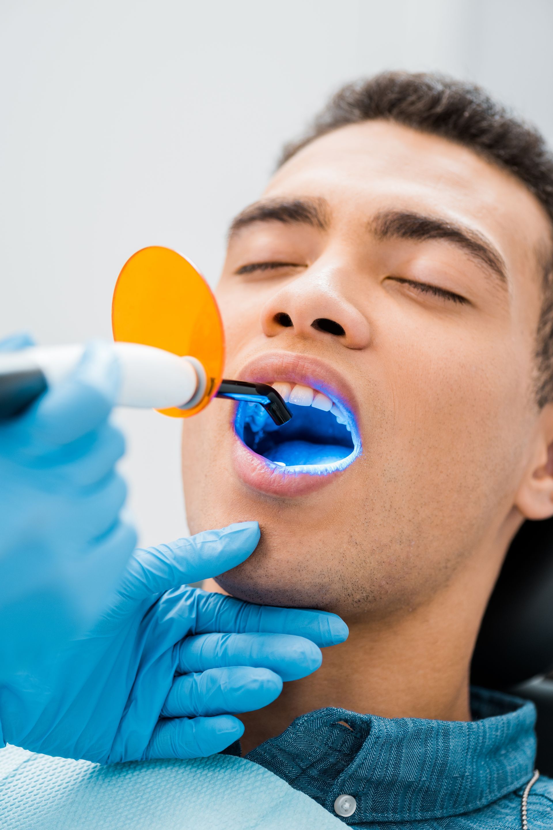Dentist applying blue dental polish to a patient’s open mouth with a small brush and orange shield