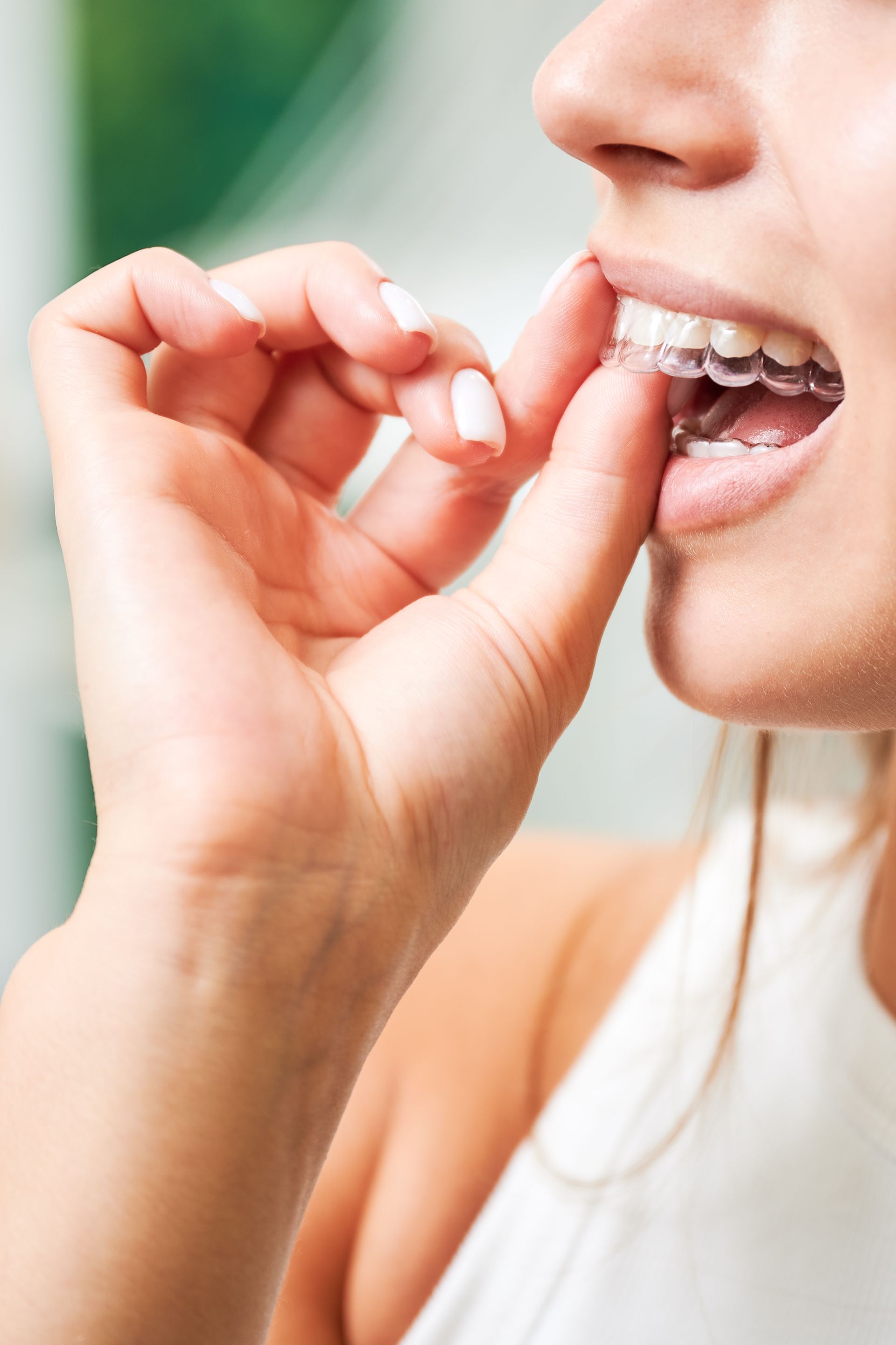 Hand placing a clear aligner on teeth in a close-up side view