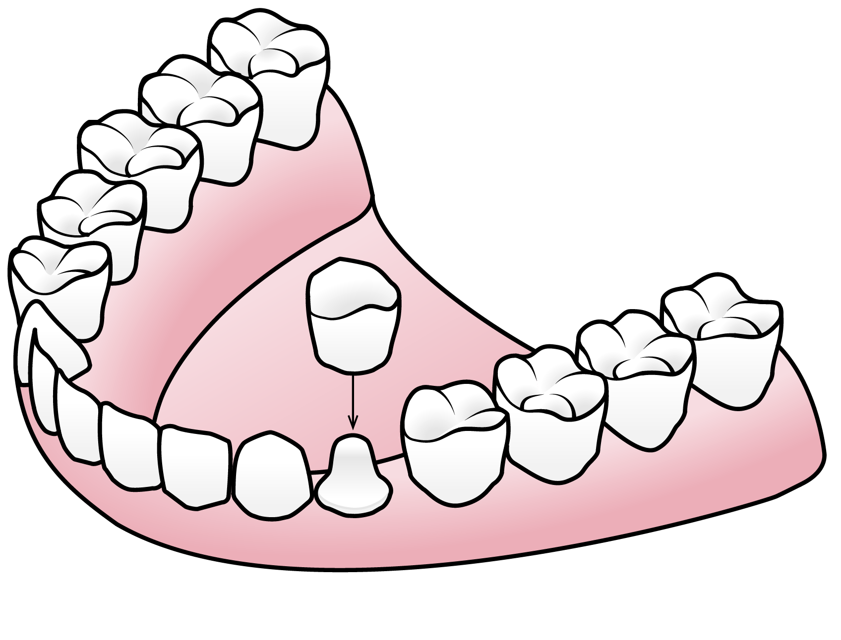 Porcelain Crowns — Valley Dental and Orthodontics