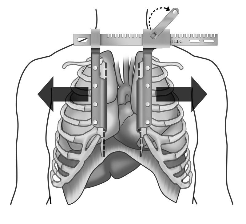 A black and white drawing of a person 's chest with a measuring device attached to it.