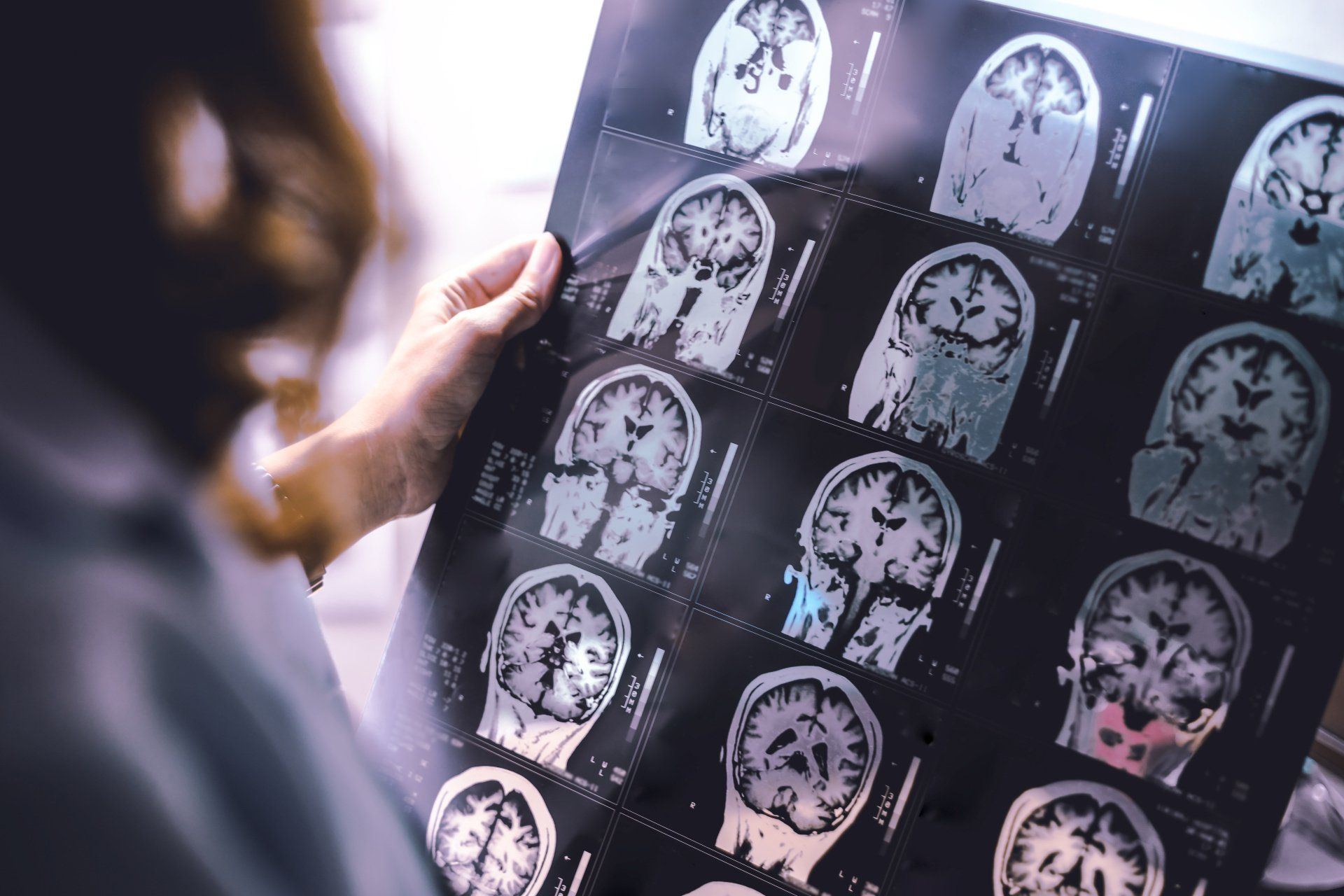 Como diagnosticar a dor de cabeça Como diagnosticar a dor de cabeça