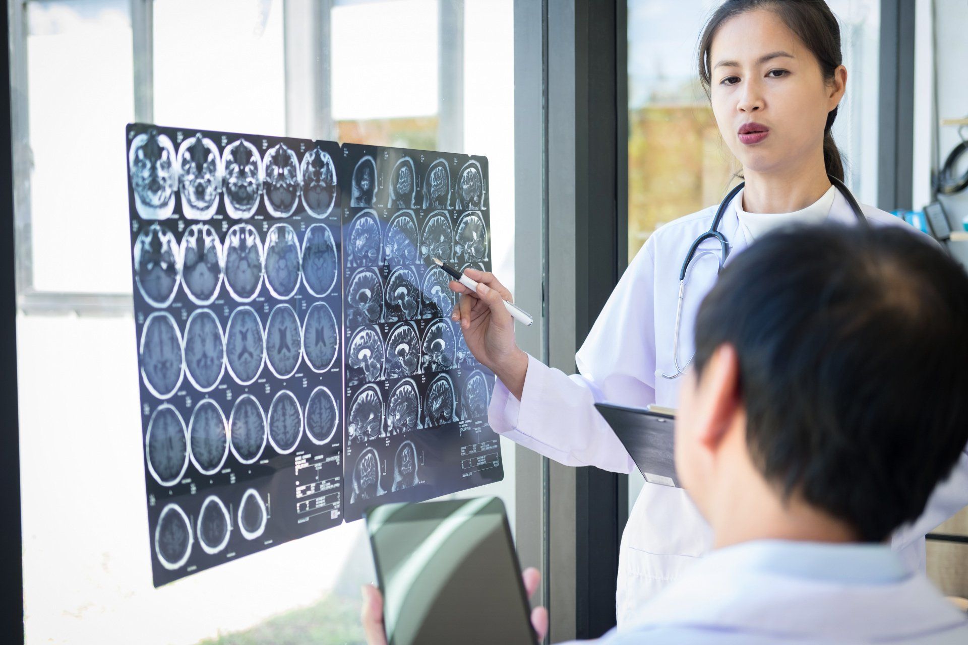 Como diagnosticar um aneurisma cerebral Como diagnosticar um aneurisma cerebral
