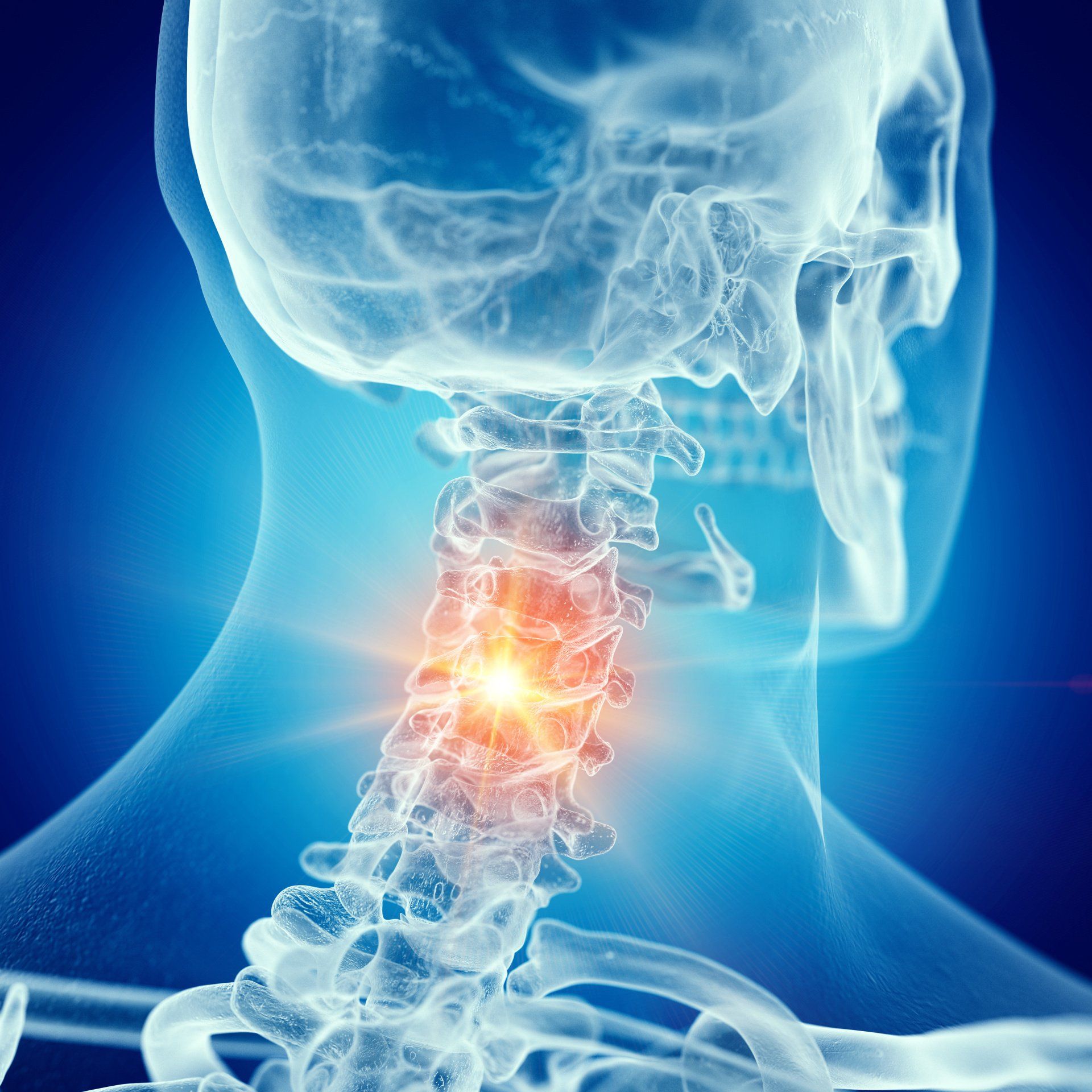 cirurgia de artrodese cervical no RJ cirurgia de artrodese cervical no RJ