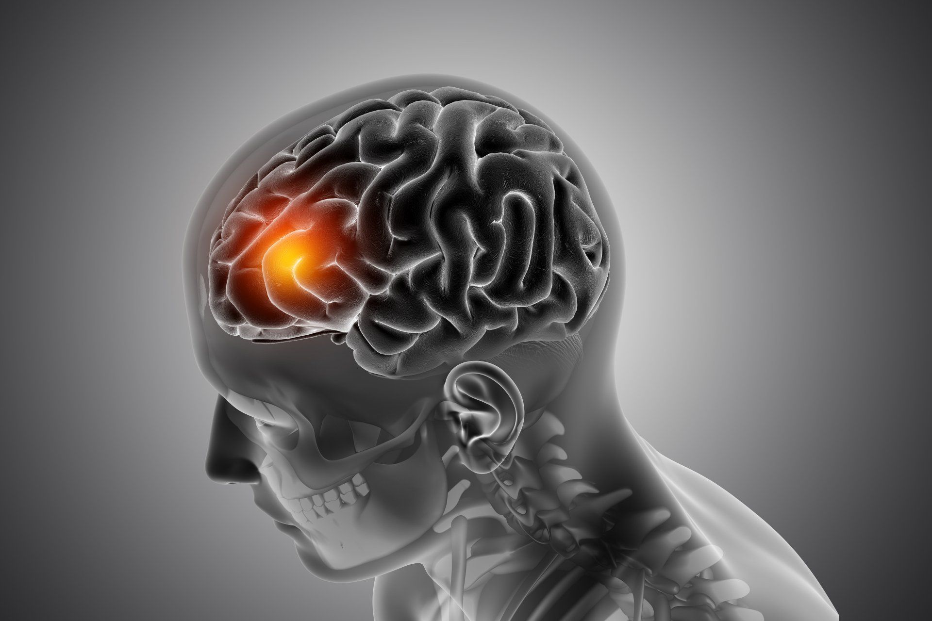 Tratar tumor cerebral em Nova Friburgo Tratamento para tumor cerebral em Nova Friburgo