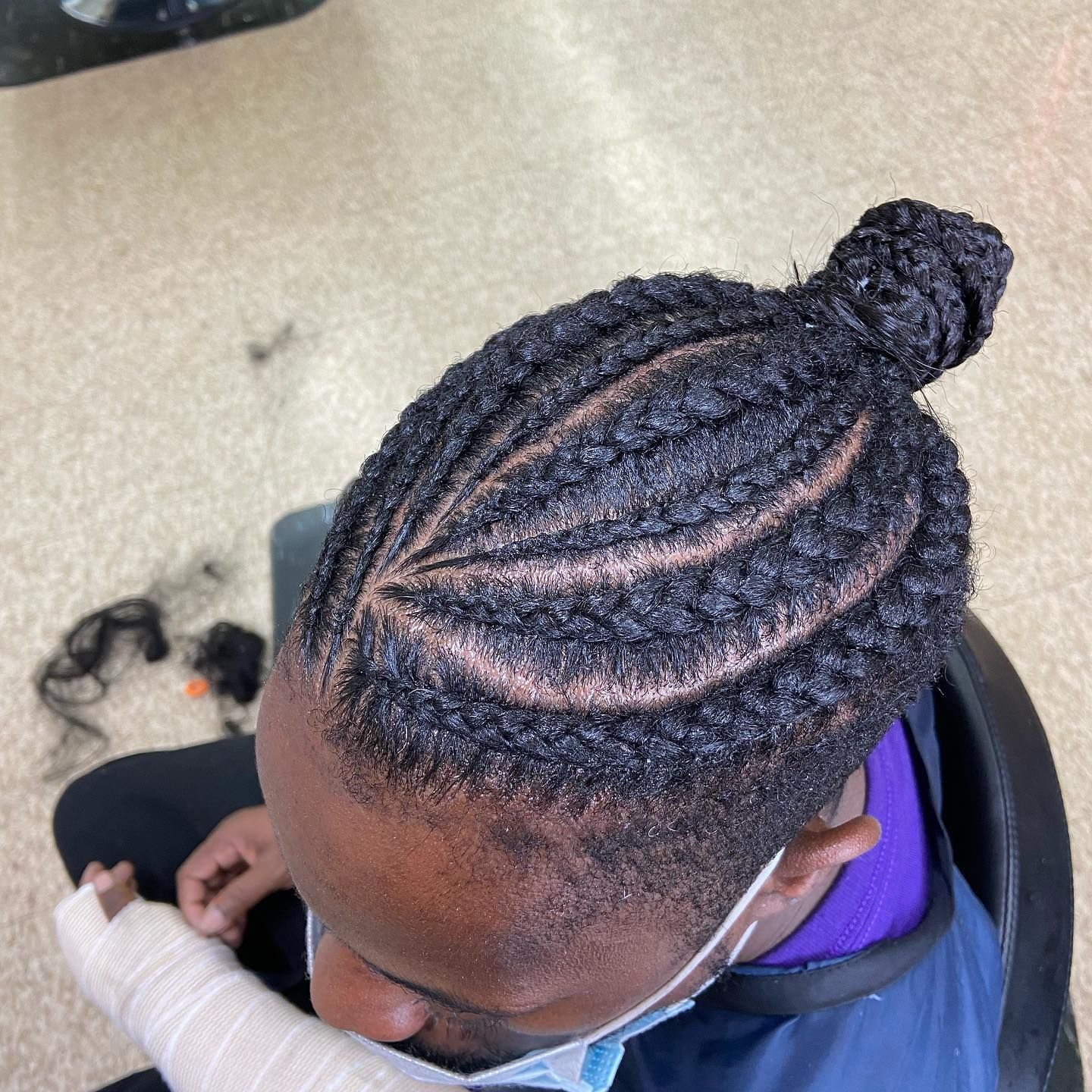 Person with braided hairstyle; some braids are in a bun. White medical wrap on the left wrist.
