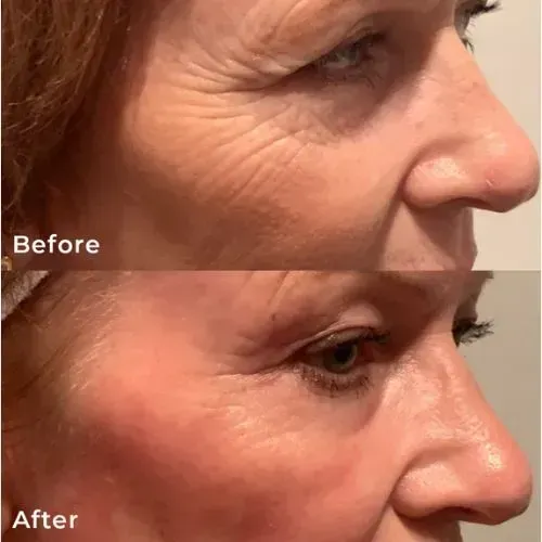 Before and After Image