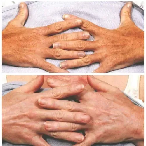 Before and After Image