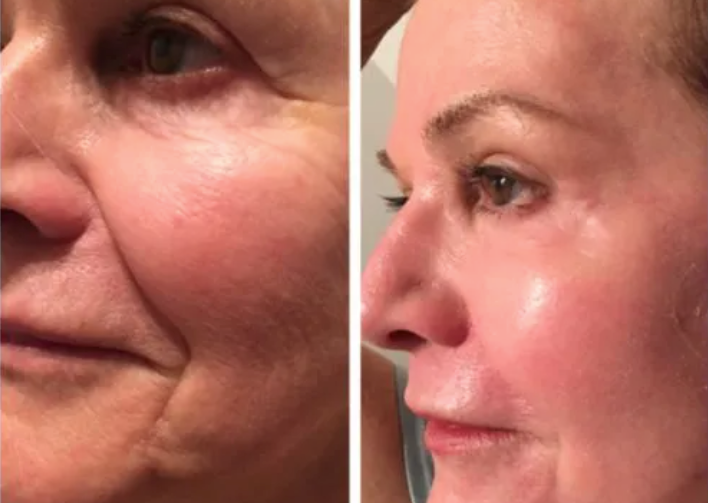 Before and After Image