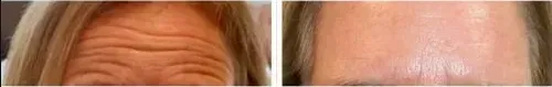 Before and After Image