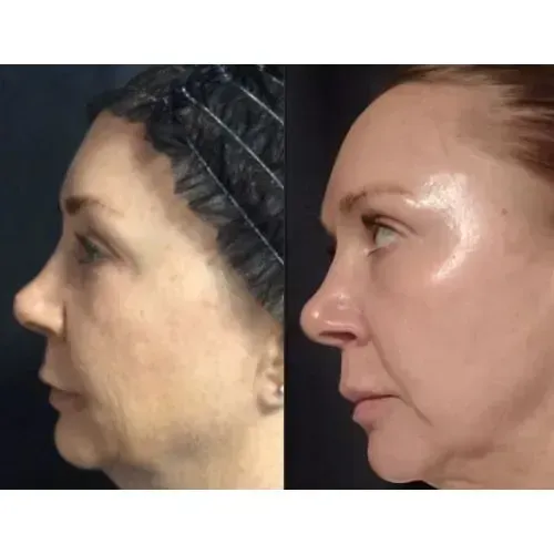 Before and After Image