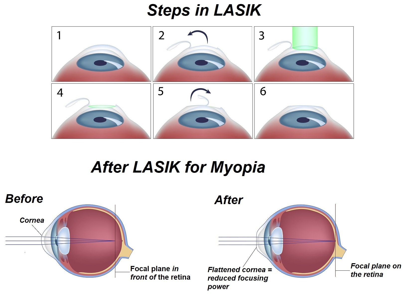 Wasatch View Eye Care Eye Doctor in South Jordan & Lehi