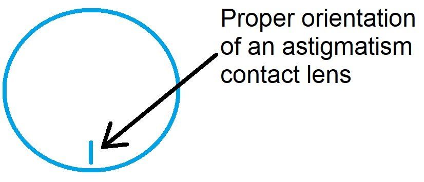 Soft contact lens for astigmatism Soft contact lens for astigmatism