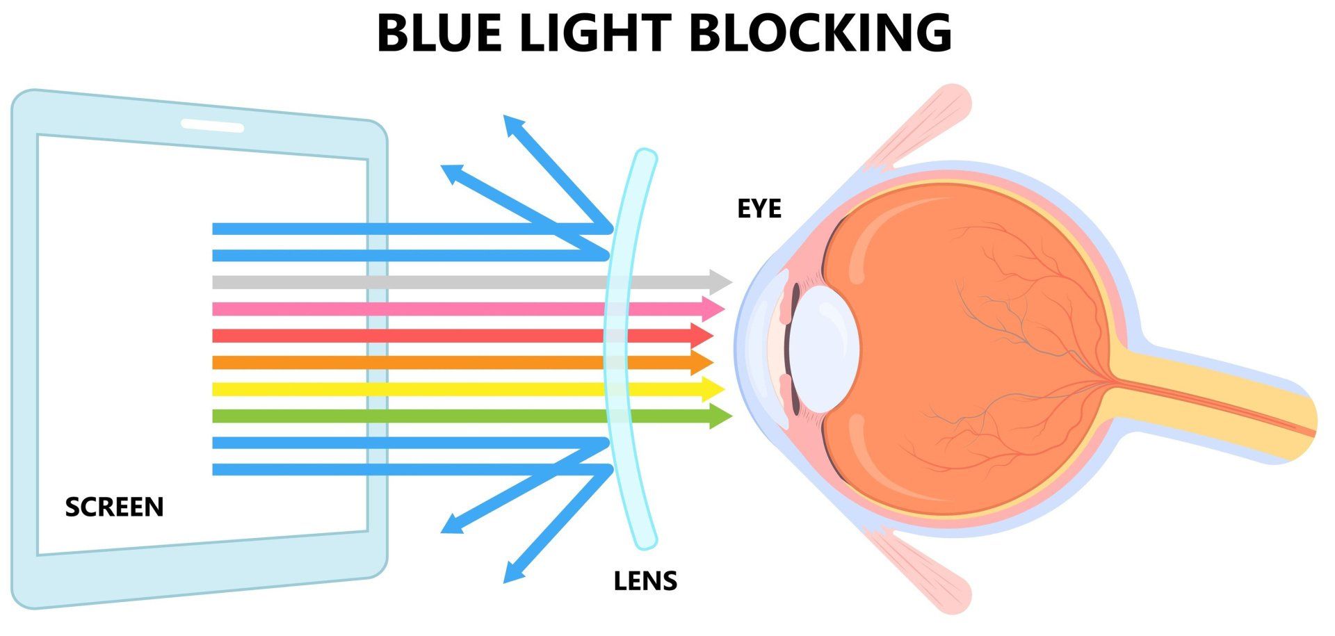 Blue blocking lenses