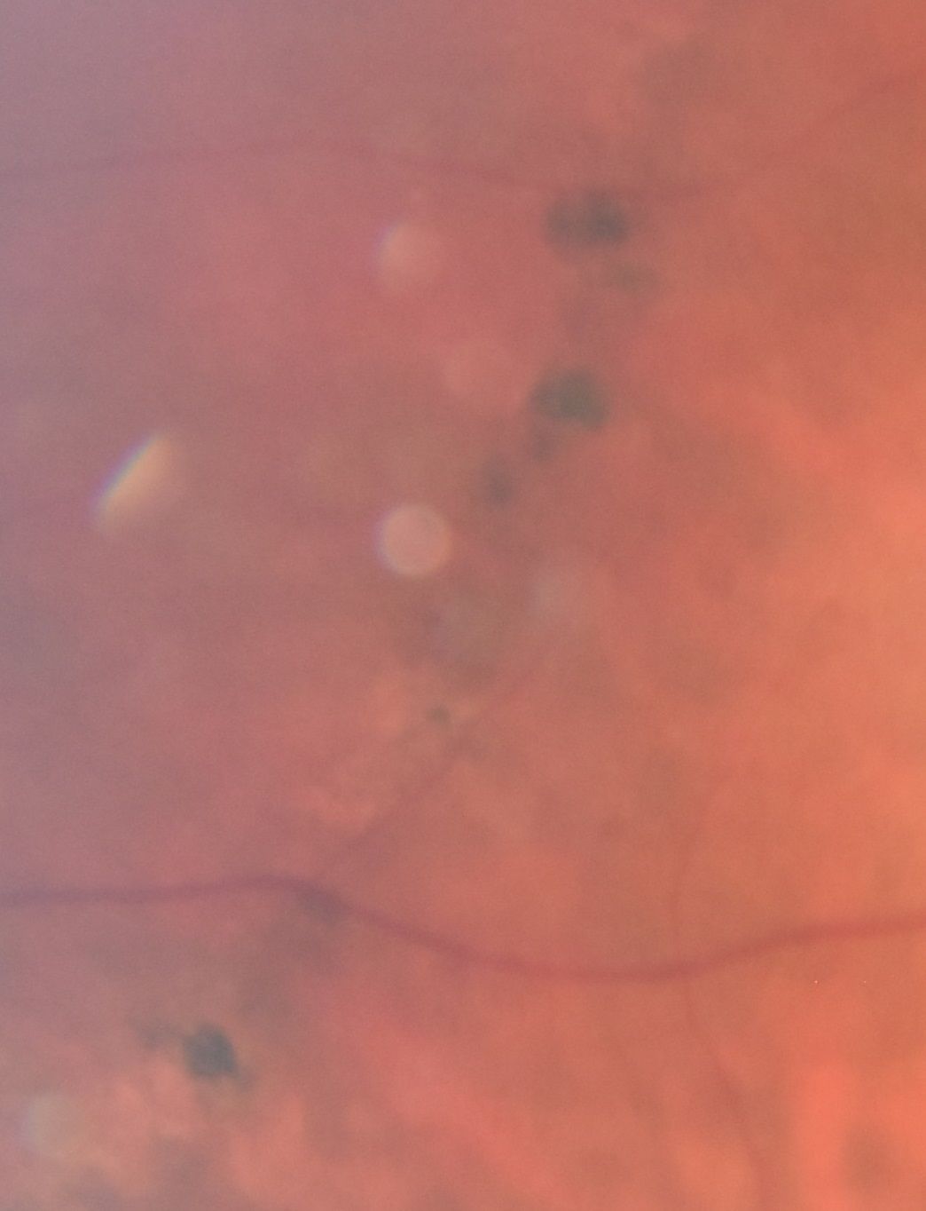 Lattice Degeneration
