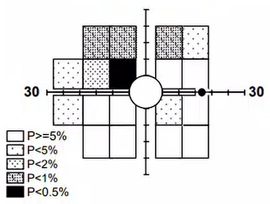 Visual Field Visual Field