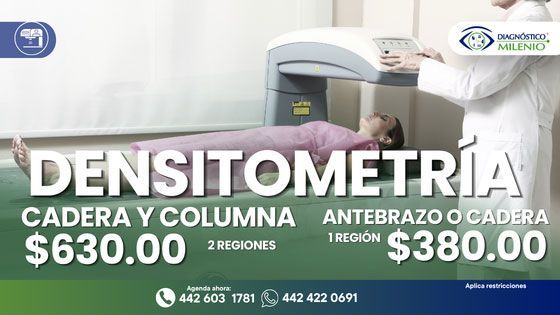 DIAGNÓSTICO MILENIO