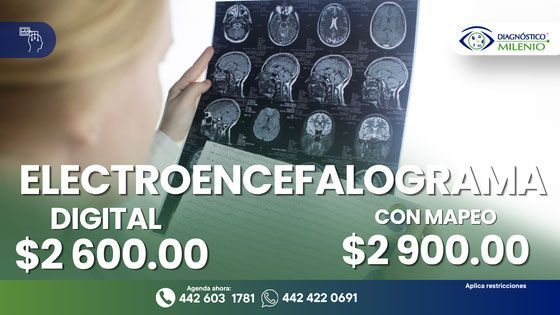 DIAGNÓSTICO MILENIO