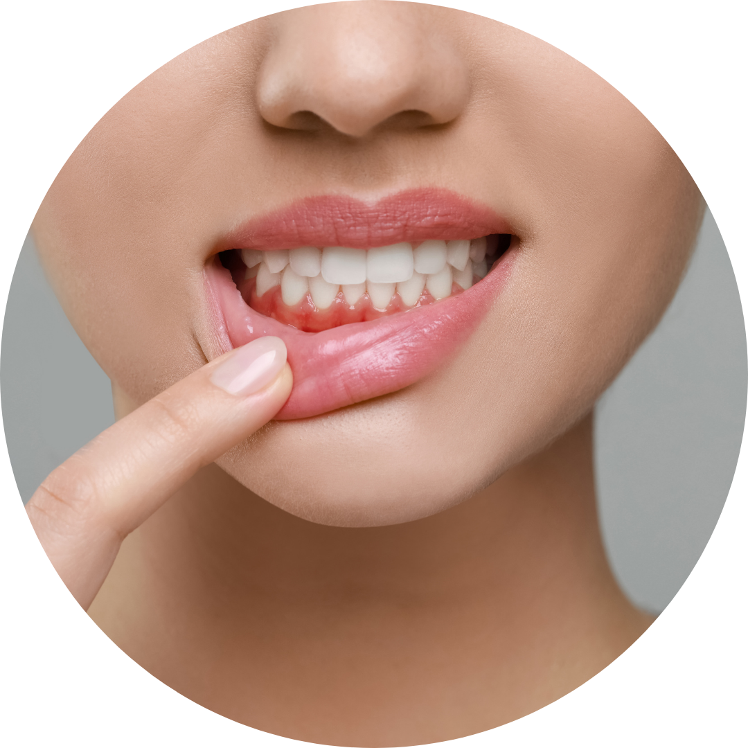 Close-up of a person pulling down their lower lip to reveal white teeth and pink gums