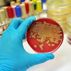 Nclostridium batteriologia