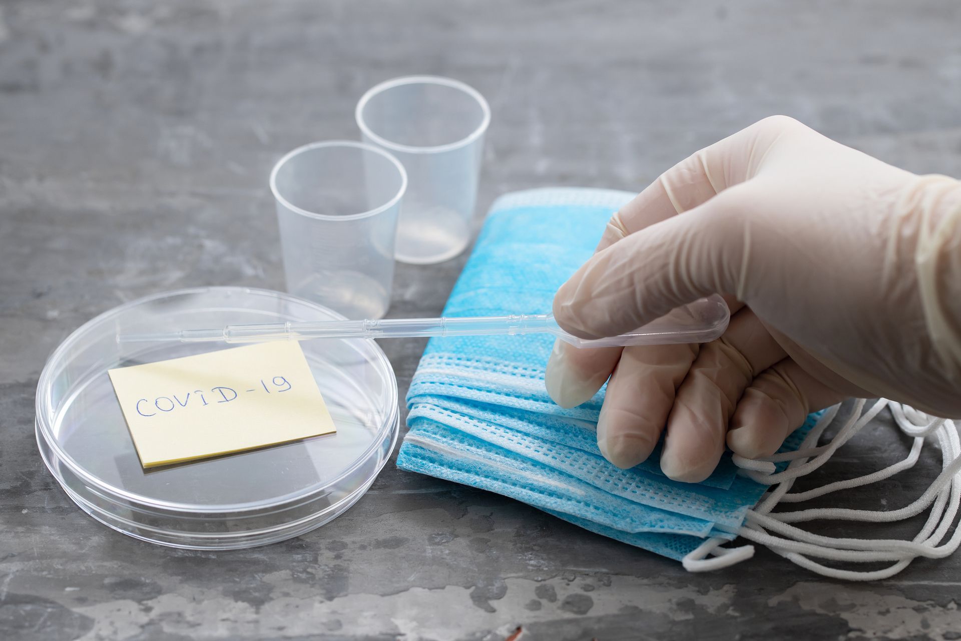 Controllo Post covid - Check Up di laboratorio per i pazienti che hanno avuto una manifestazione