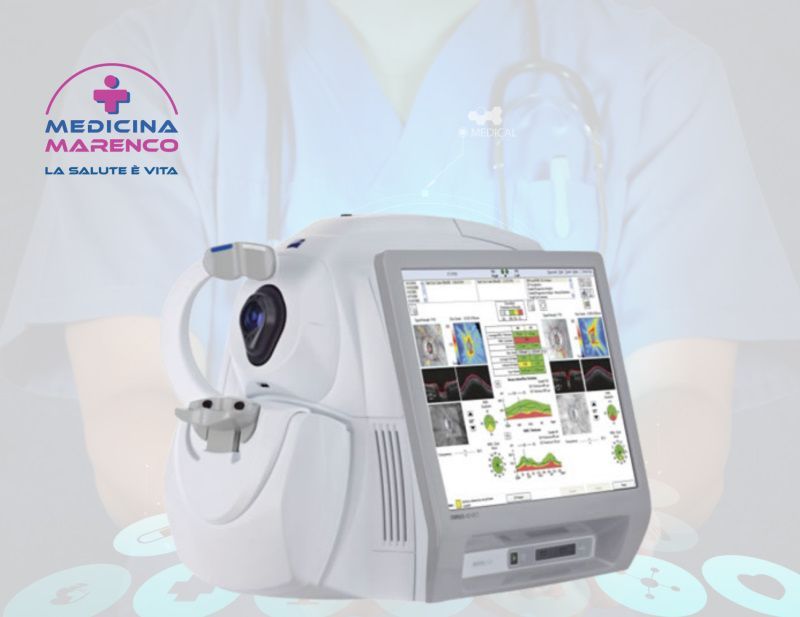 OCT per studio macula e papilla ottica
