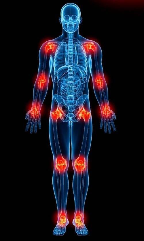 A 3d rendering of a man with arthritis in his joints.