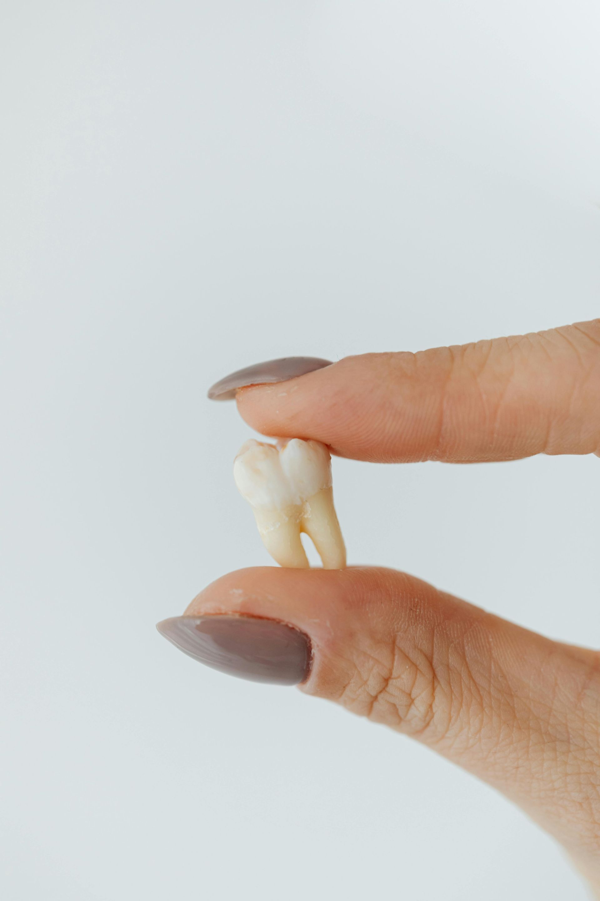 Wisdom teeth removal or extraction