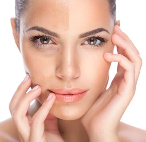 FARMACIA DERMICA DE QUERETARO - Protectores solares