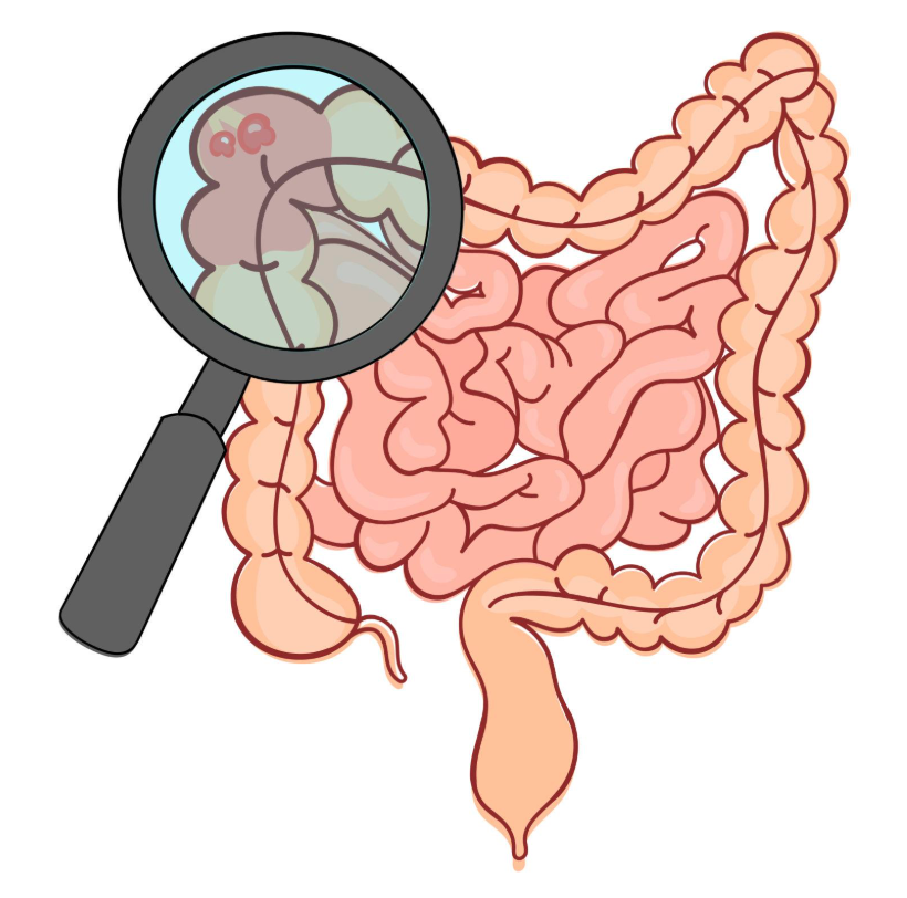 polyps of the colon and rectum