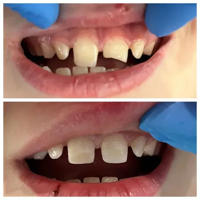 before and after
