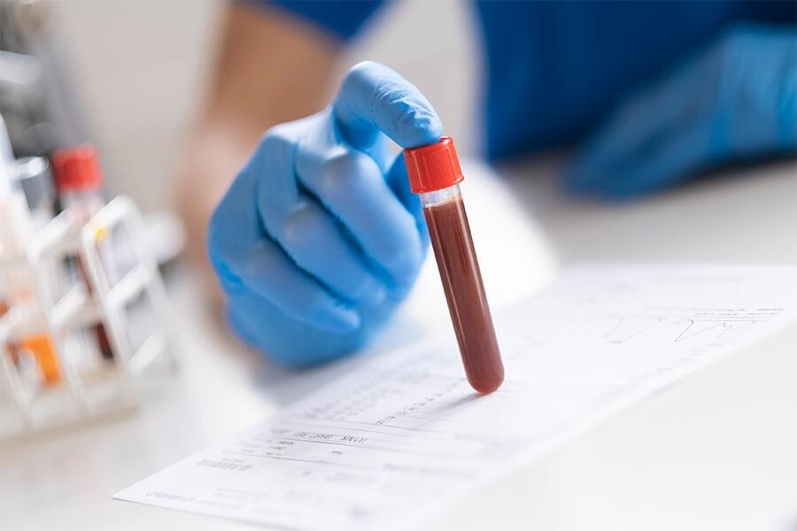 DRA TERESA DE LA VEGA MAYORAL - Anemia