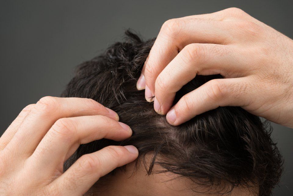 applicazione prodotto per problemi di caduta capelli