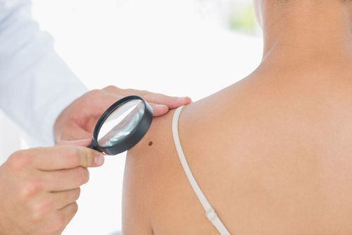 A Doctor Is Examining a Woman 's Back with A Magnifying Glass — Health Hub Mackay in Bowen, QLD