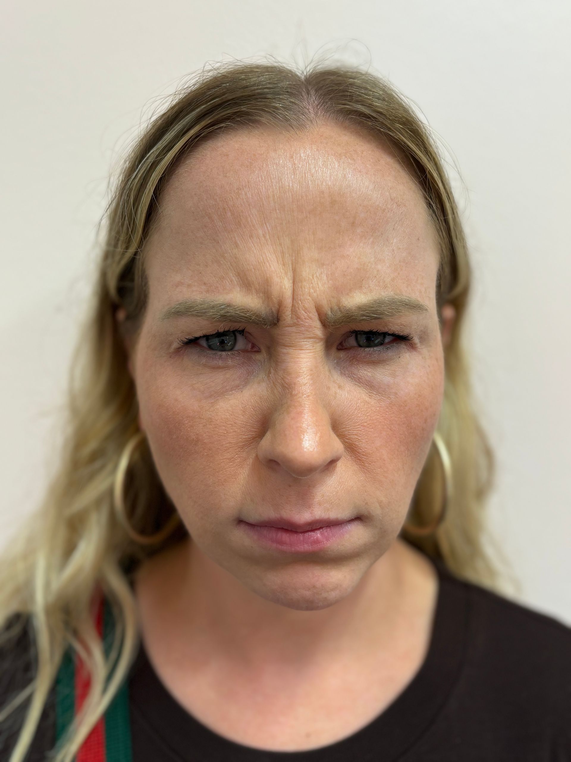 A woman with wrinkles on her forehead is making a funny face.