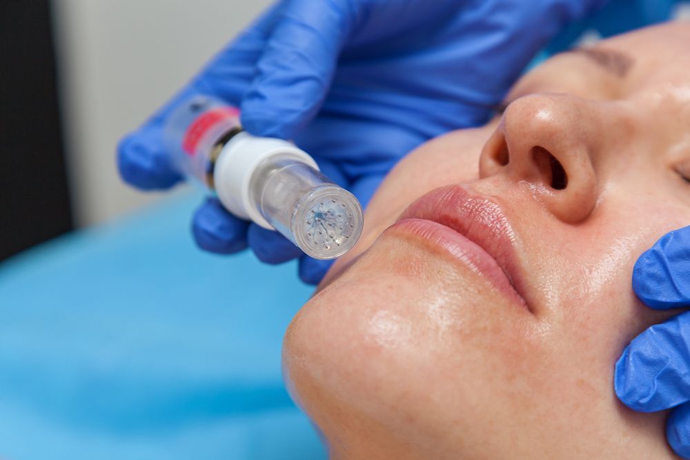 A woman is getting a botox injection in her face.