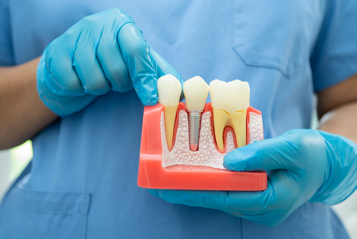 Gloved hands hold a dental implant model with teeth and gums in a clinic setting