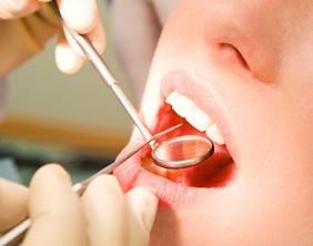 Dentist examining open mouth with dental mirror and probe on a patientโs teeth