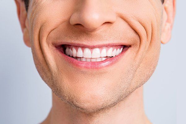 Teeth Whitening — Antioch, CA — New City Dental Practice